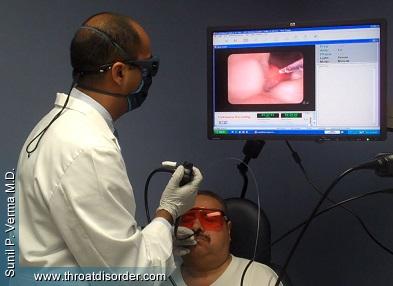 KTP Laser Surgery - Voice and Swallowing Doctor - Sunil Verma MD