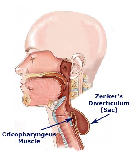stomach ache after semaglutide Semaglutide Stomach Pain Relief Tips